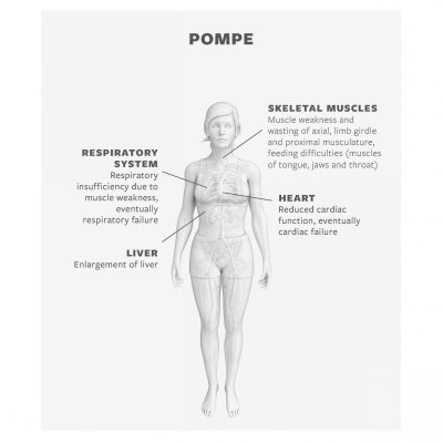 Pompe Pharming